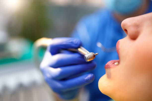 Dental Bonding in Conway, PA